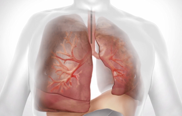 lung-20211231_g11.jpg