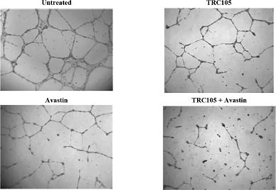 6168-1_vascular_str_k_line_v1.eps