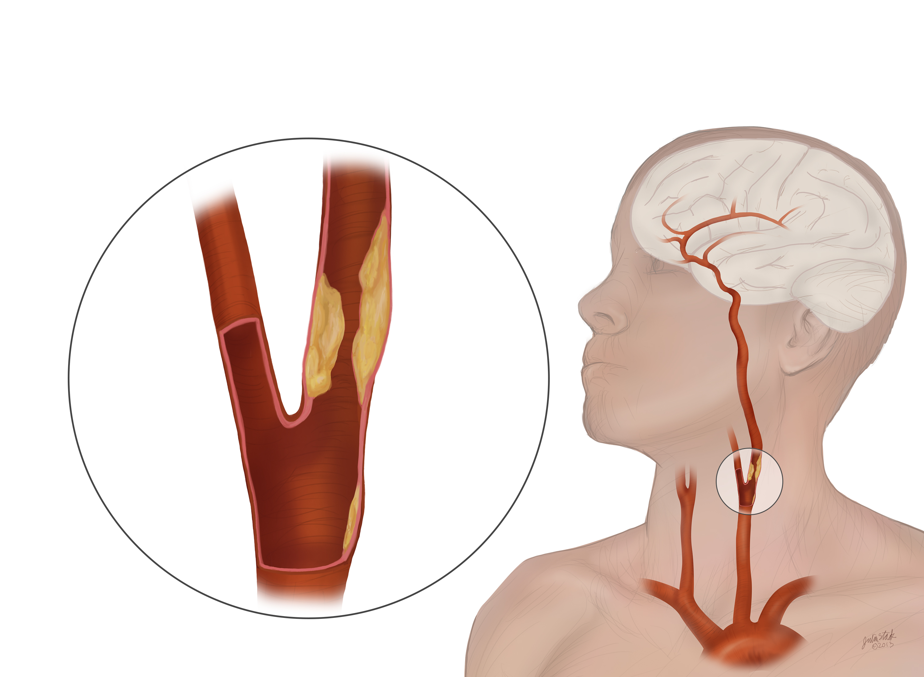 cerebrovascularsystem.jpg