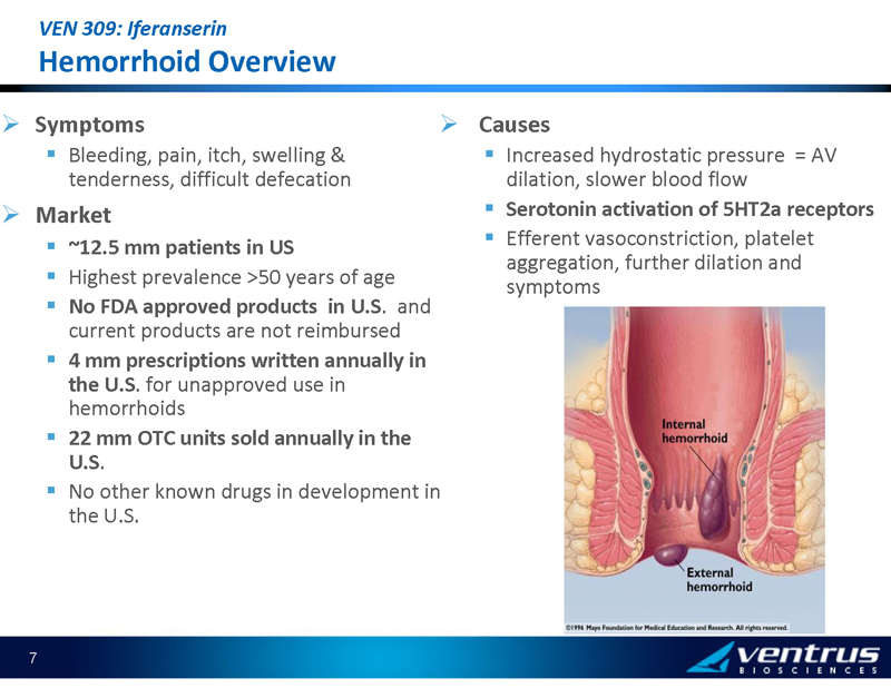 Ven 309iferanserin Novel Treatment For Hemorrhoids