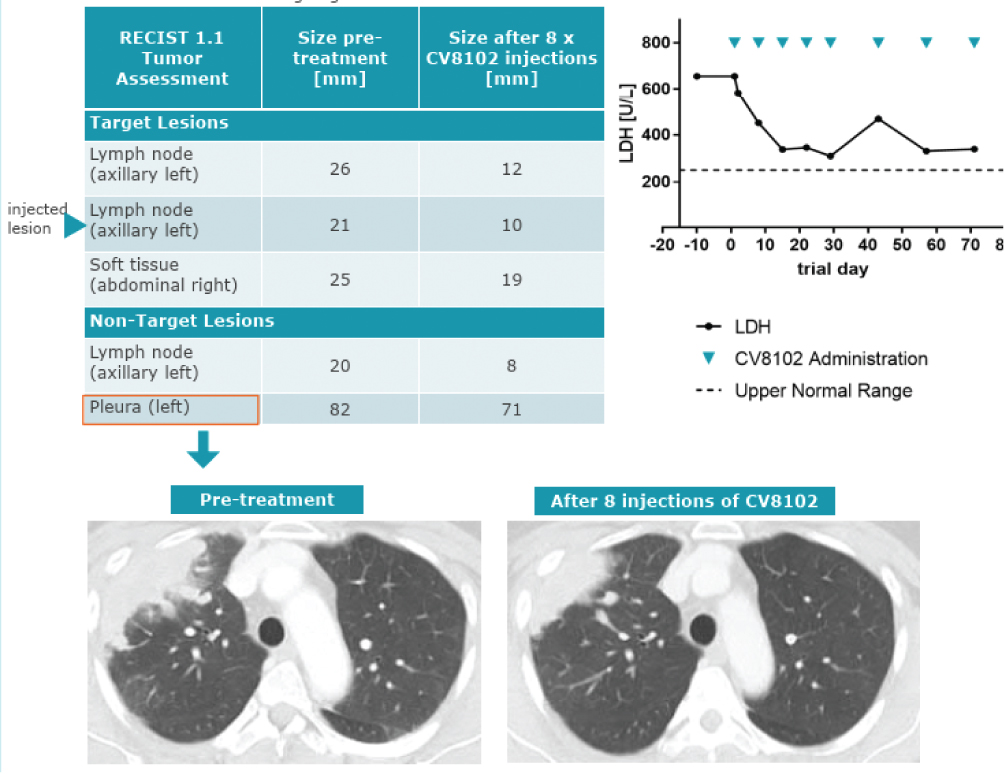 [MISSING IMAGE: tm2016252d6-ph_lesions4clr.jpg]