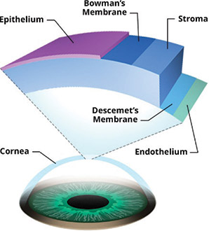 [MISSING IMAGE: ph_cornea-4clr.jpg]