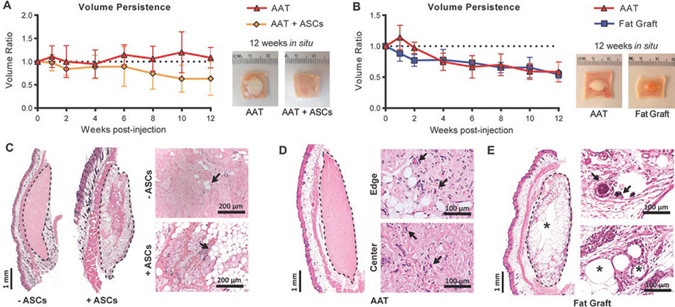 [MISSING IMAGE: ph_phagocytes-4clr.jpg]